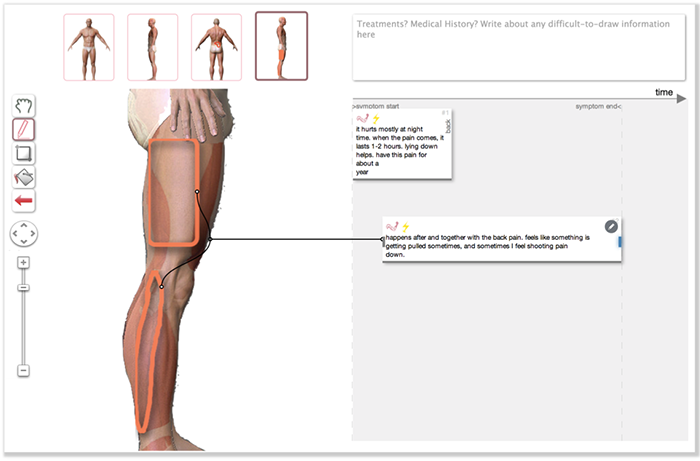 Figure for BodyDiagrams: Improving Communication of Pain Symptoms through Drawing